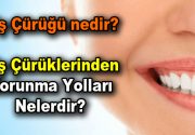 Diş Çürüğü nedir? Diş Çürüklerinden korunma yolları nelerdir? Diş sağlığı,