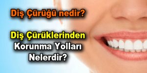 Diş Çürüğü nedir? Diş Çürüklerinden korunma yolları nelerdir?