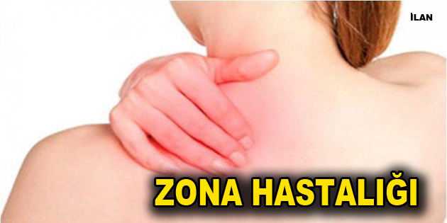 Zona Hastalığı