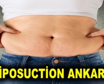 LİPOSUCTİON ANKARA
