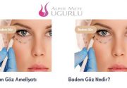 Göz Altı Torbası Ameliyatı Göz altındaki torbalar, her erkekte, kadında