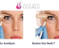 Göz Altı Torbası Ameliyatı