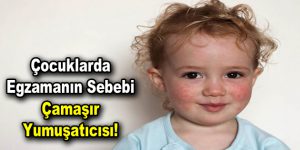 Çocuklarda Egzamanın sebebi çamaşır yumuşatıcısı