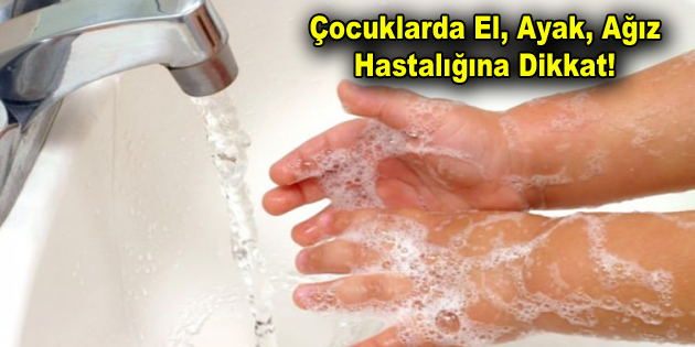 Çocuklarda El, Ayak, Ağız Hastalığına Dikkat! Çocuklarda El, Ayak, Ağız Hastalığına Dikkat! El, ayak, ağız hastalığı,