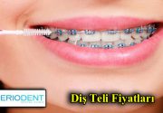 Diş Teli Fiyatları Diş teli çeşitleri başta olmak üzere diş