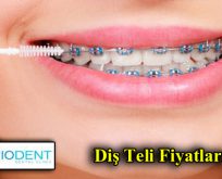 Diş Teli Fiyatları