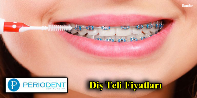 Diş Teli Fiyatları