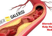 Aterosklerotik Kalp Hastalığı Nedir? Koroner kalp hastalıkları, dünyada erken ölümlerin