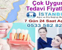 Beşiktaş İmplant Diş Fiyatları