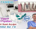 Kağıthane İmplant Diş Fiyatları Hastane Doktoru Telefon: 0533 582 82 79