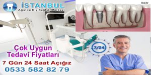 Kağıthane İmplant Diş Fiyatları Hastane Doktoru Telefon: 0533 582 82 79