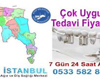 Eyüp İmplant Diş Fiyatları Hastane