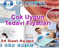 Fatih İmplant Diş Fiyatları Uzman Hastane Doktor Telefonu GSM: 0533 582 82 79