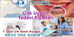 Fatih İmplant Diş Fiyatları Uzman Hastane Doktor Telefonu GSM: 0533 582 82 79