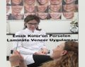 Emek Külür’ün Porselen Laminate Veneer Uygulaması