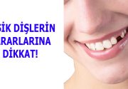 EKSİK DİŞLERİN ZARARLARINA DİKKAT! Ortodonti Uzmanı Doç. Dr. Erol Akın konu hakkında