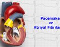 Pacemaker Ve Atriyal Fibrilasyon