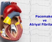 Pacemaker Ve Atriyal Fibrilasyon