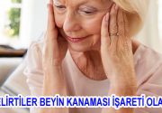 BU BELİRTİLER BEYİN KANAMASI İŞARETİ OLABİLİR! Anevrizma yani halk dilinde