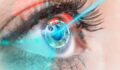 Lasik Göz Ameliyatı Nedir? Kimler İçin Uygundur?