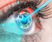 Lasik Göz Ameliyatı Nedir? Kimler İçin Uygundur?
