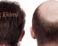 En İyi 10 Saç Ekimi Kliniği