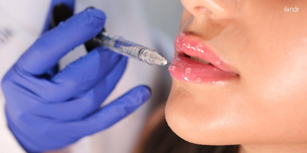 Dudak Dolgusu Yaptırmadan Önce Bilmeniz Gerekenler Nelerdir?